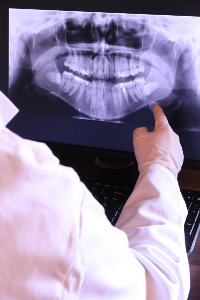 Best Emergency Wisdom Teeth Removal in Pine Ridge At Crestwood, NJ