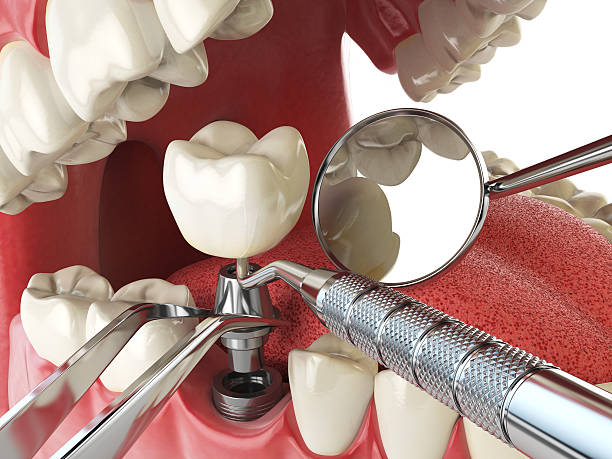 Best Emergency Tooth Extraction in Pine Ridge At Crestwood, NJ